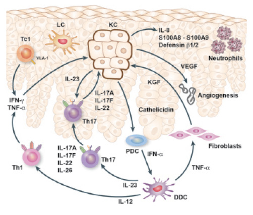 Systemic Inflammation In Psoriasis A Guide For Dermatology Care Providers Practical Dermatology